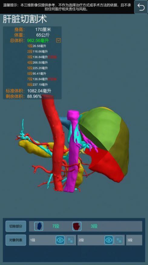 微乐手术模拟系统  v1.1.9图2