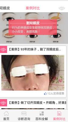 双眼皮咨询APP  v1.0.2图5