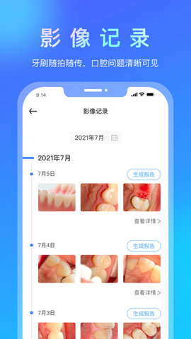 悦牙云  v1.0.3图2